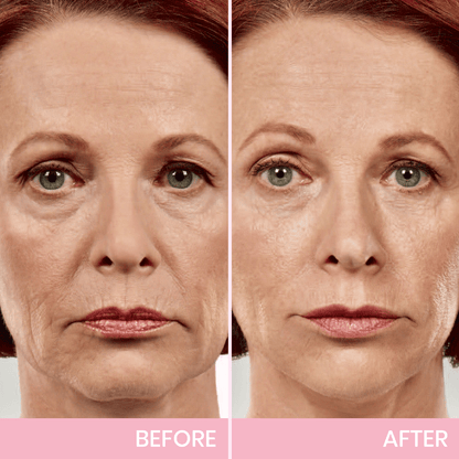 ✨ BBOJI™ Invisible Face Lift Tape 💖 Instantly Sculpt Your Jawline & Hide Double Chin